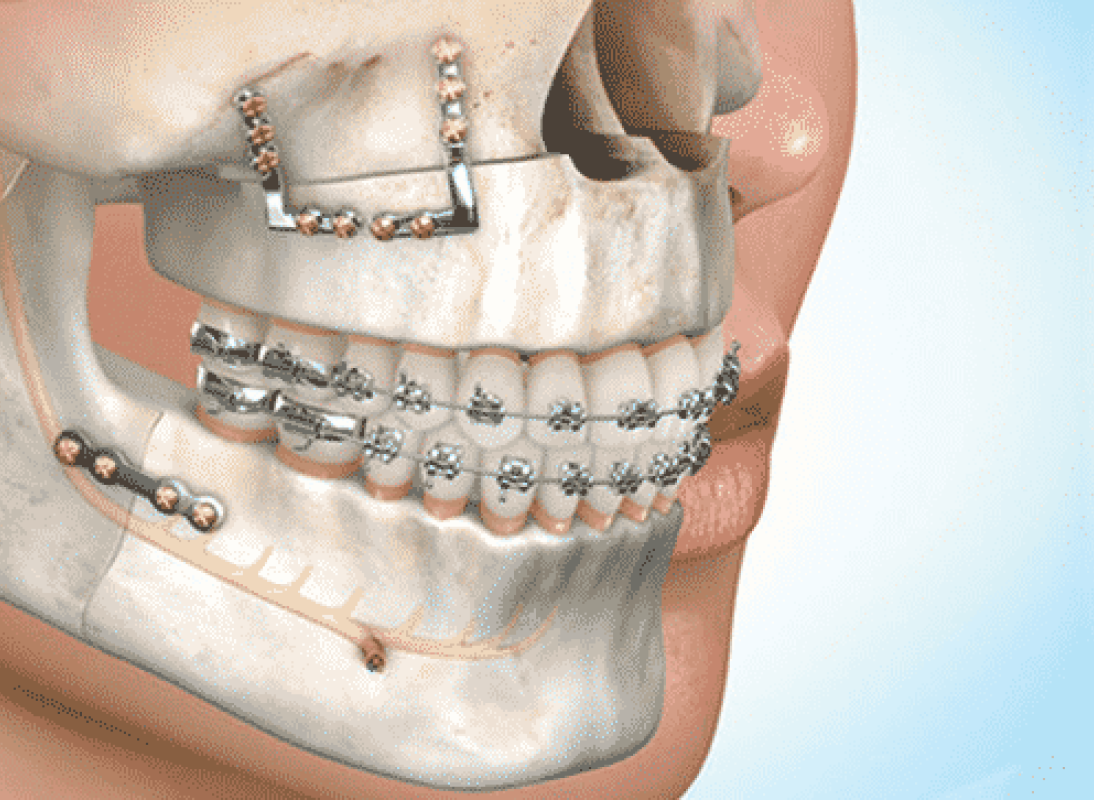 Oral and Maxillofacial