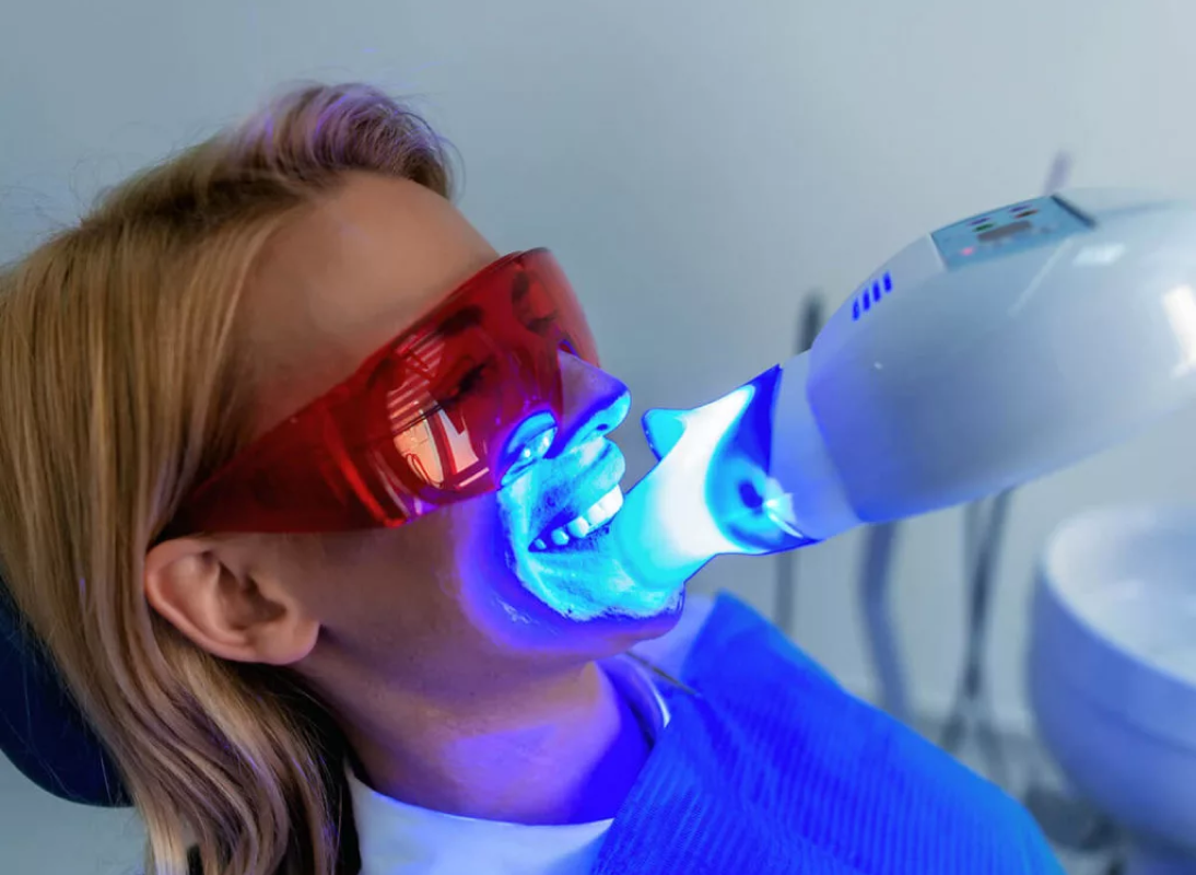 Teeth Whitening